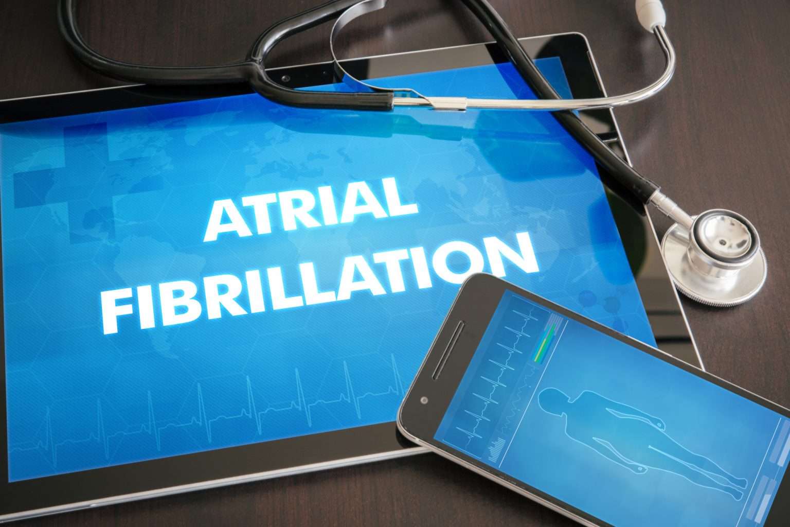 You have Been Diagnosed with Atrial Fibrillation