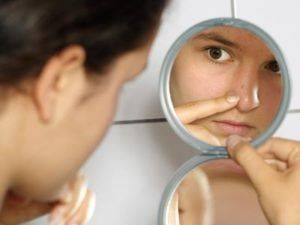 acne mirror